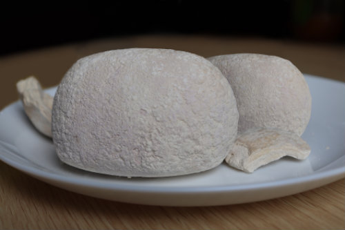 武漢京都結石醫(yī)院