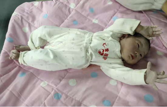 胎兒臍帶繞頸3周，醫(yī)生助力成功生產(chǎn)